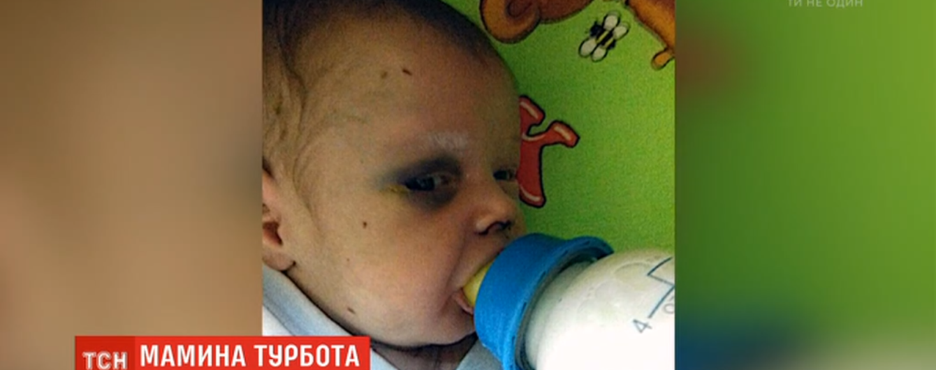 У Рівному мати залишила немовля у гуртожитку і зникла. Малюка знайшли ледь живого після її побиття