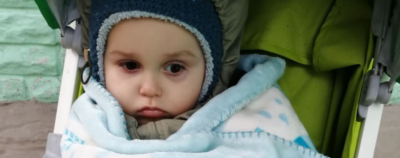 Лікарі видалили Микиті пухлину з голівки і тепер потрібне протирецидивне лікування