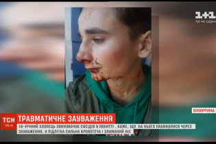 На Винниччине соседи избили подростка из-за того, что он сделал замечание не мусорить в подъезде