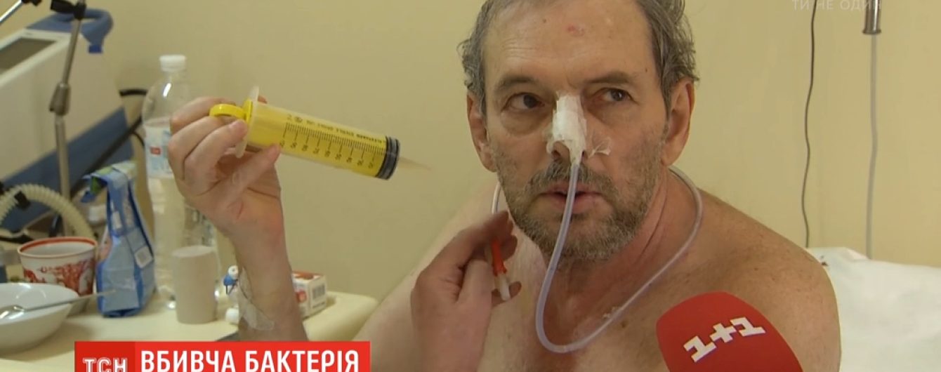 Киянин з'їв в'яленої риби і потрапив з ботулізмом до реанімації