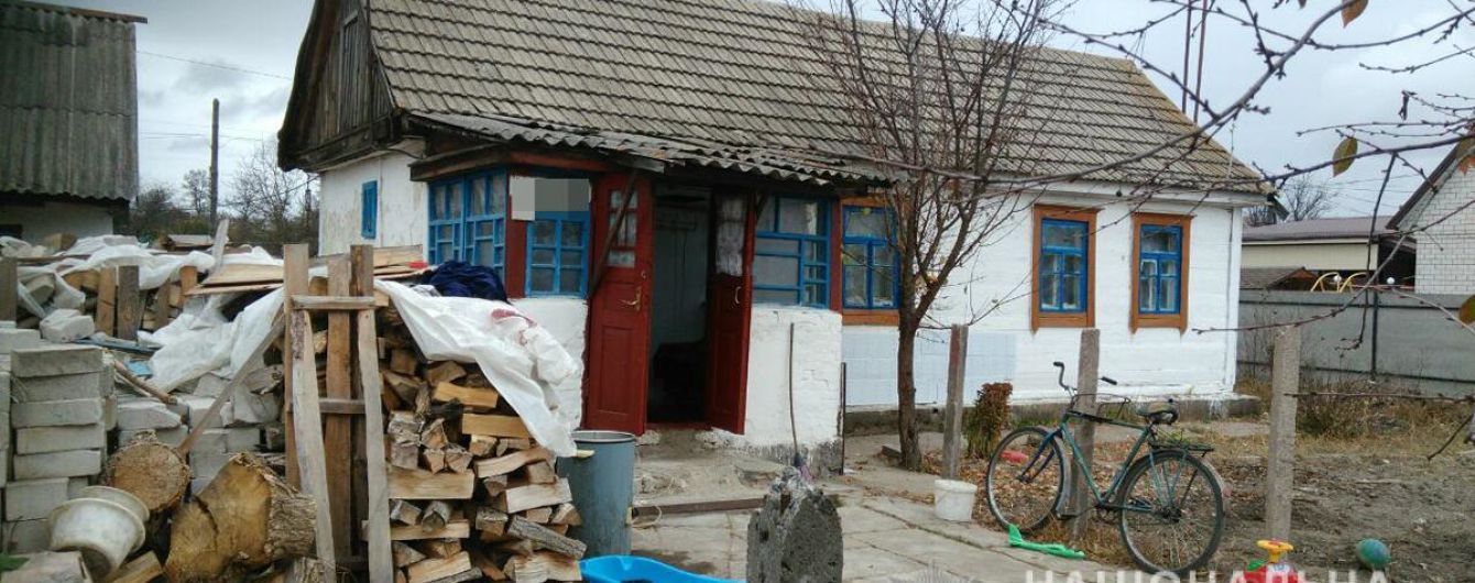В Житомирской области 4-летний ребенок облился кипятком. Родители сутки не обращались к медикам