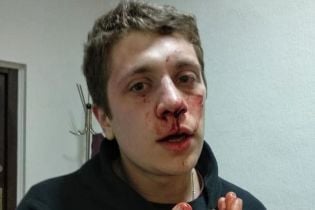 У Дніпрі активіст заявив про побиття невідомими у балаклавах