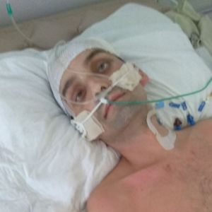 После нападения молодчиков Сергей нуждается в длительном лечении