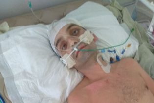 После нападения молодчиков Сергей нуждается в длительном лечении