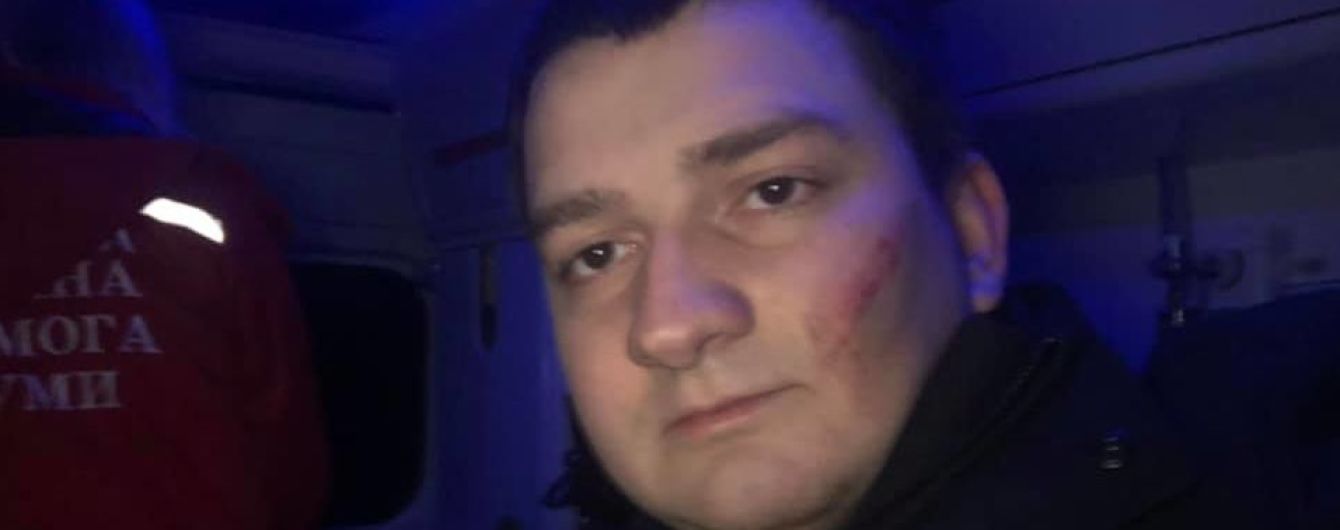 Нардеп від "Слуги народу" заявив про побиття в Сумах