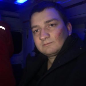 Нардеп от "Слуги народа" заявил об избиении в Сумах