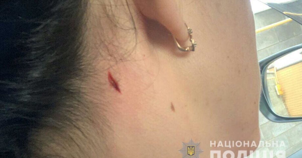 Жінка у Миколаєві під час стрільб поліцейських отримала поранення в шию