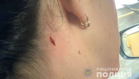 Жінка у Миколаєві під час стрільб поліцейських отримала поранення в шию