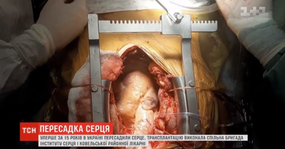 В Украине впервые за 15 лет пересадили сердце
