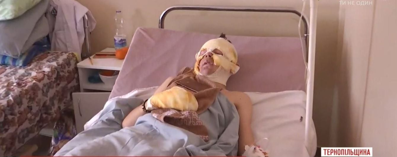 Врачи рассказали, в каком состоянии находятся пострадавшие от взрыва в сельском клубе мальчики