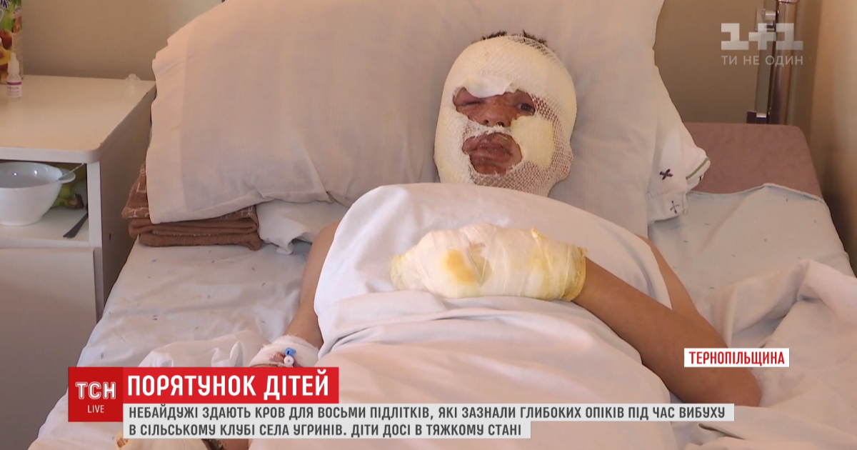 Стан постраждалих хлопчиків під час вибуху в сільському клубі на Тернопільщині покращився - медики