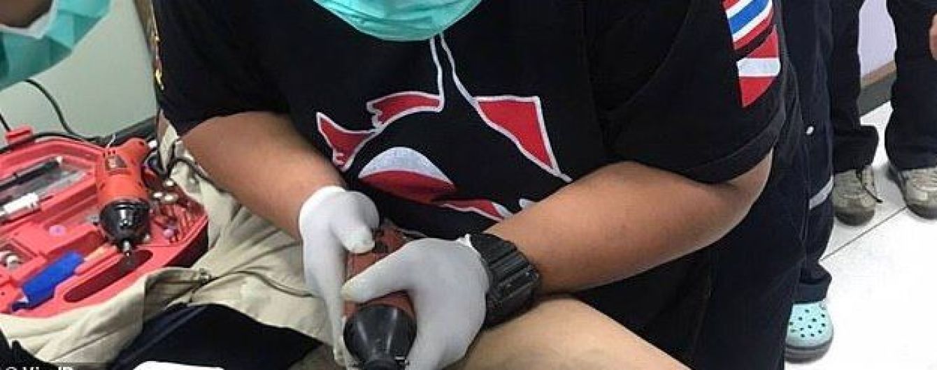 Таец 5 дней ходил с трубой на пенисе после неудачной мастурбации. Орган начал гнить