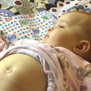 Багатостраждальна родина з Львівщини потребує допомоги в оплаті лікування доньки