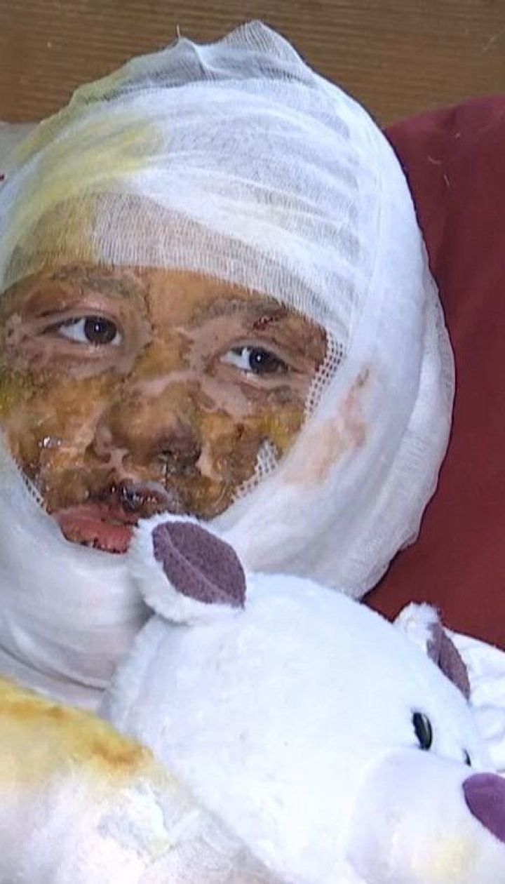 У Чернівцях нетверезий чоловік облив бензином та підпалив 16-річну доньку