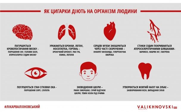 Инфографика предоставлена автором