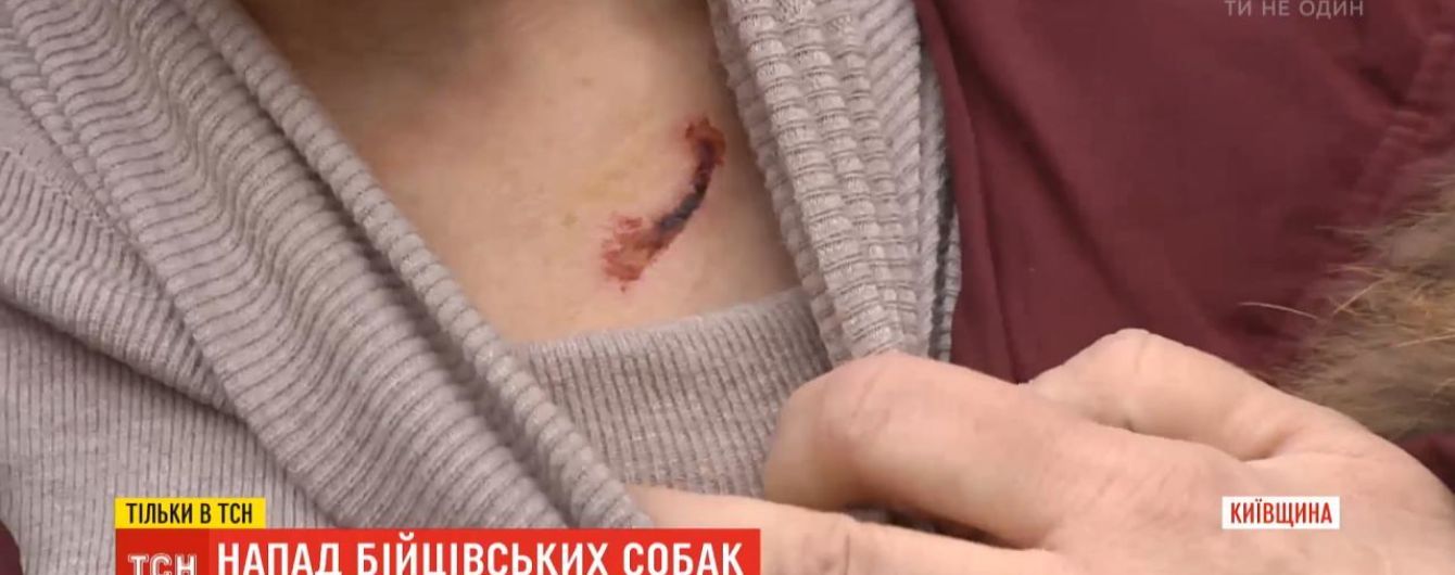 На Київщині бійцівські собаки, які гуляють без намордників і повідків, напали на двох жінок