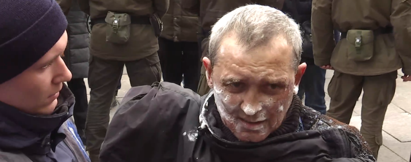 Мужчина, который поджег себя под стенами АП, объяснил свой поступок