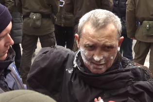 Чоловік, який підпалив себе під стінами ОП, пояснив свій вчинок