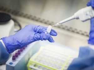 ПЛР-тест на коронавірус: де зробити в Києві та скільки це коштує