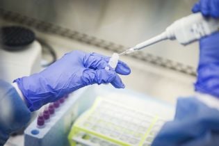 В Україні приватні клініки замовляють і проводять платні тести на коронавірус для охочих