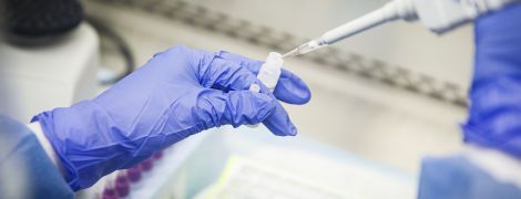 ПЦР-тест на коронавирус: где сделать в Киеве и сколько это стоит