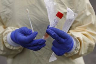 У ВООЗ назвали вартість тестів на виявлення коронавірусу