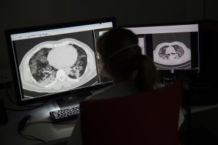У Тернопільській області коронавірус виявили у 18 медиків лікарні: чому склалася критична ситуація