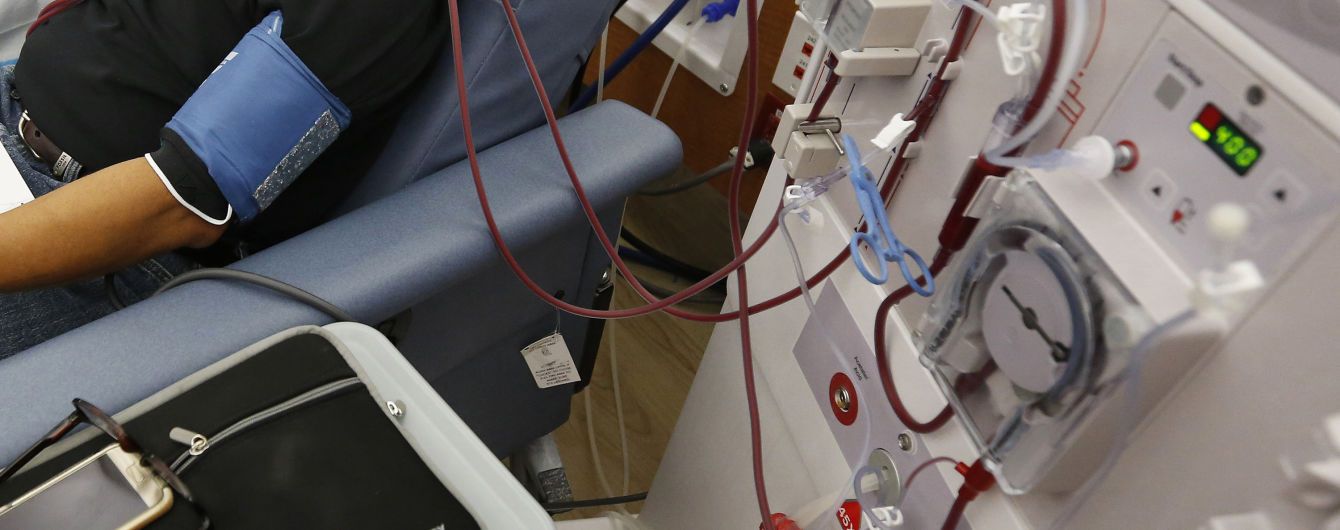 Канадські вчені першими в світі почали лікувати COVID-19 за допомогою спеціалізованого діалізу