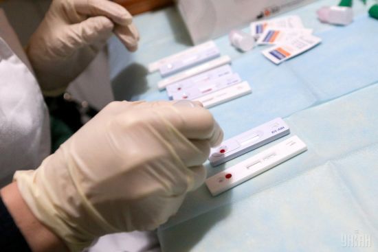 На Київщині зафіксовано випадок захворювання на вірусний гепатит А