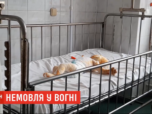 3-річний брат підпалив ковдру: у Рівненській області 8-місячне немовля зазнало тяжких опіків