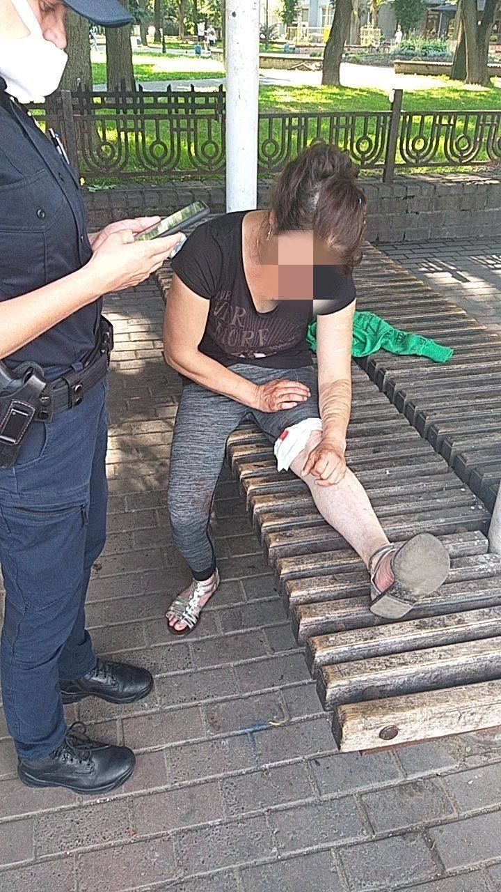 вдарив по голові, Франківськ,_3
