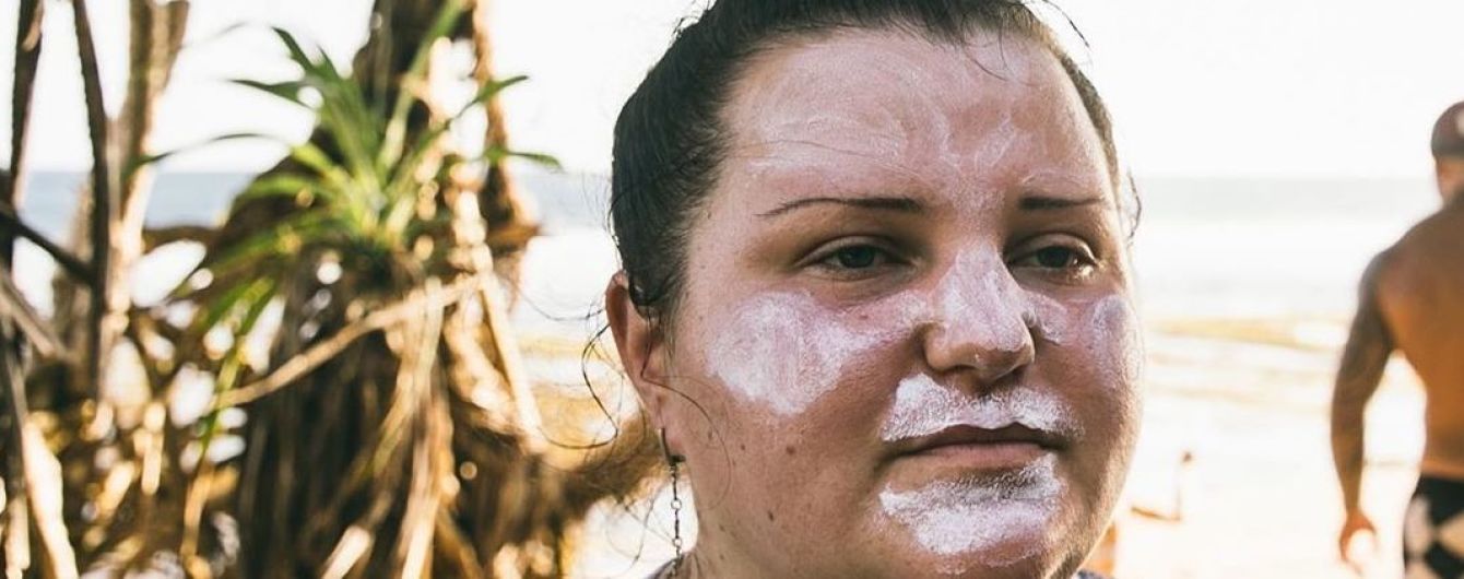 Реперша alyona alyona рассказала о проблемах со здоровьем