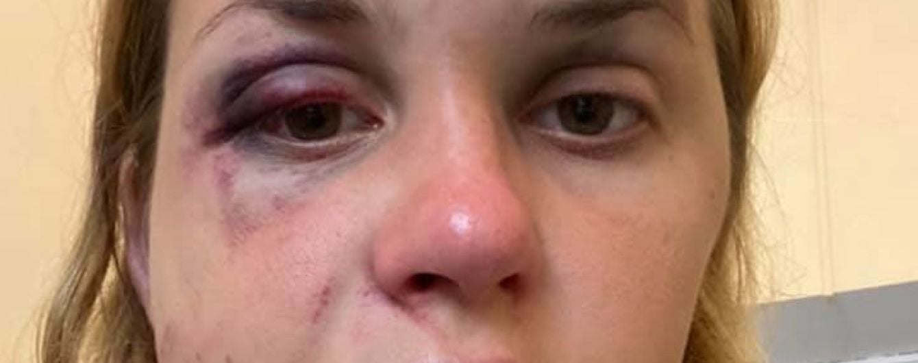 У поїзді "Маріуполь-Київ" чоловік у трусах напав на жінку з дитиною і намагався зґвалтувати