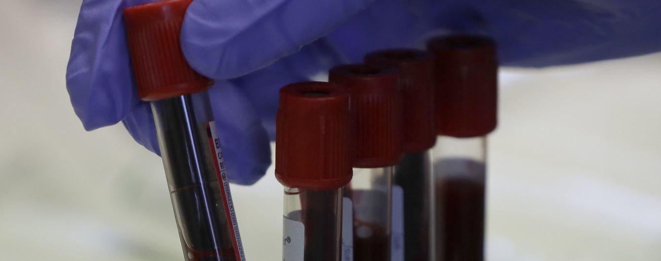 Лікування коронавірусу плазмою крові: як працює метод та чи дозволено це в Україні