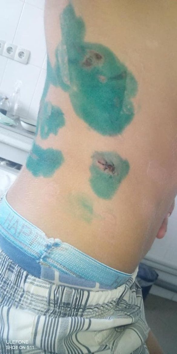 укуси собаки