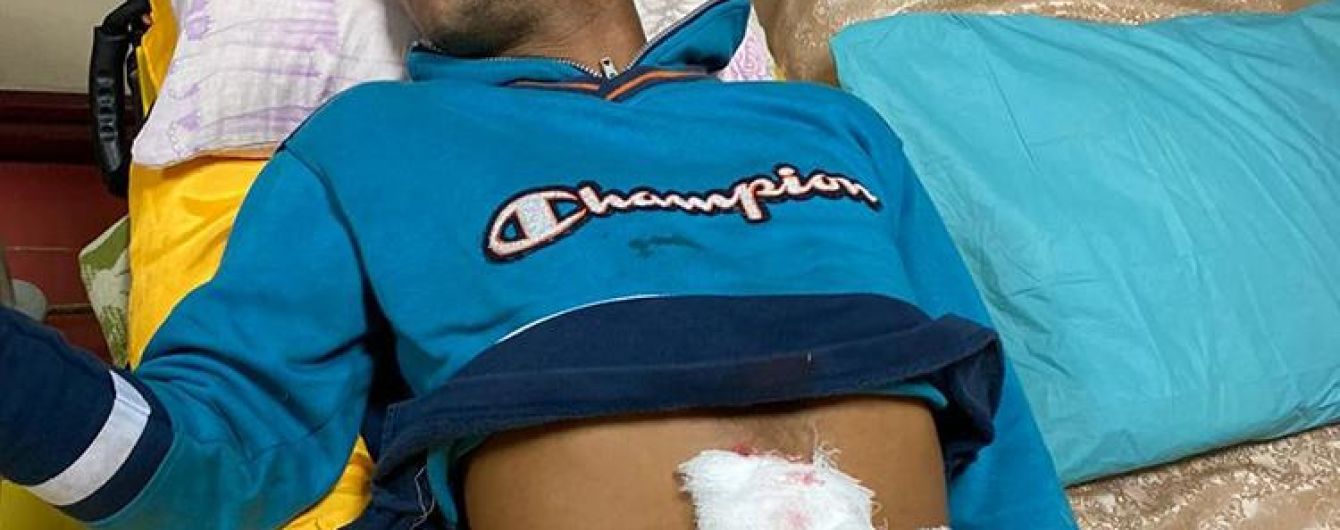 Йшов 2 км, стікаючи кров’ю: у Тернопільській області через їжу підрізали 20-річного хлопця