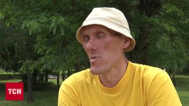 Чоловіку 49, а він ще досі росте! 