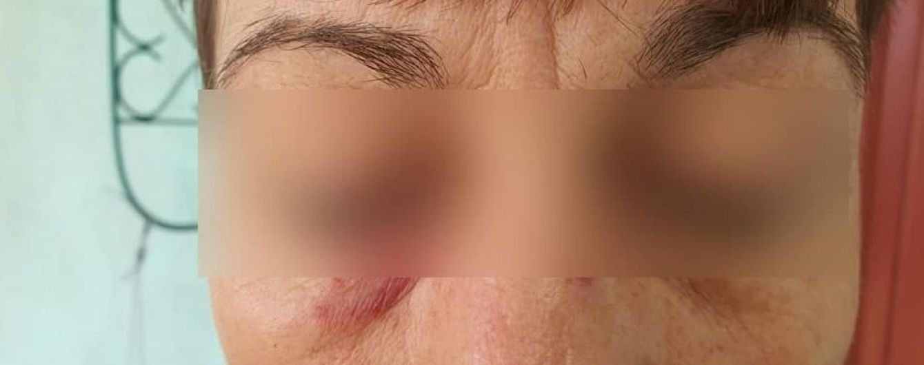В Сумах пассажирка жестоко избила кондуктора из-за маски: фото
