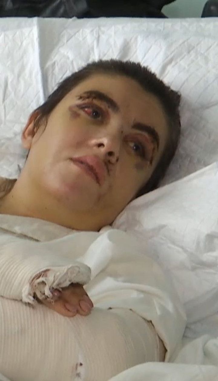 Погрожував, знущався та побив до крові: ТСН поспілкувалася із жертвою 45-річного киянина