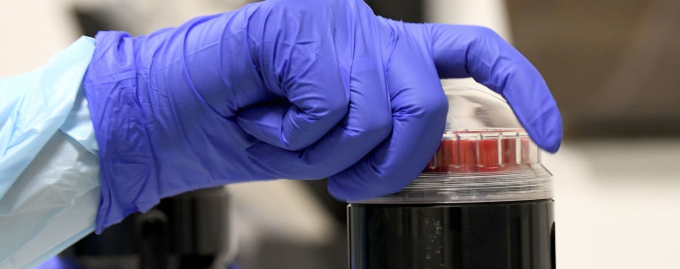 Невідома хвороба атакувала добровольця, який отримав вакцину Johnson & Johnson від коронавірусу