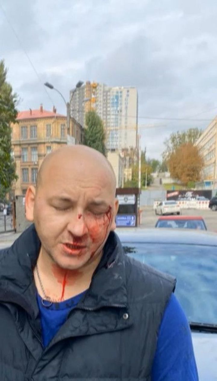 В центре Киева из-за дорожной спор избили бывшего учасника АТО и его жену