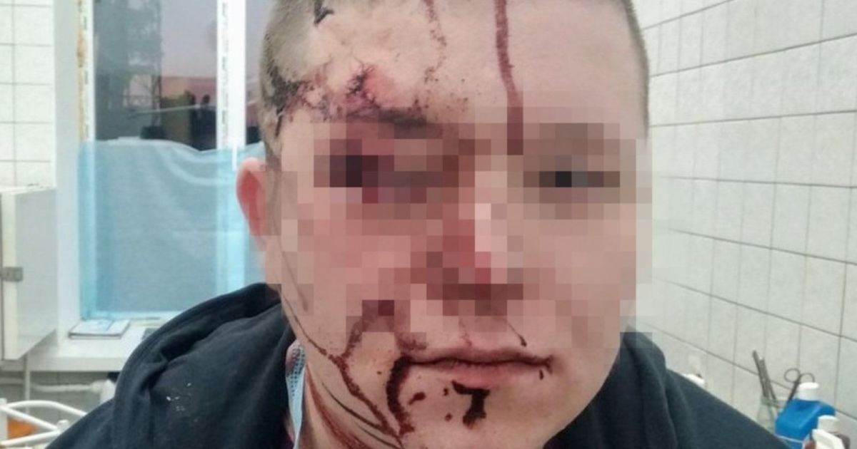 "Не понравились стены": в киевской больнице пациент ударил врача по голове металлическим стулом