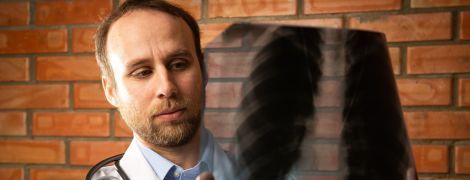 Що краще робити для діагностики коронавірусу – КТ чи рентген: лікар-інфекціоніст пояснив деталі