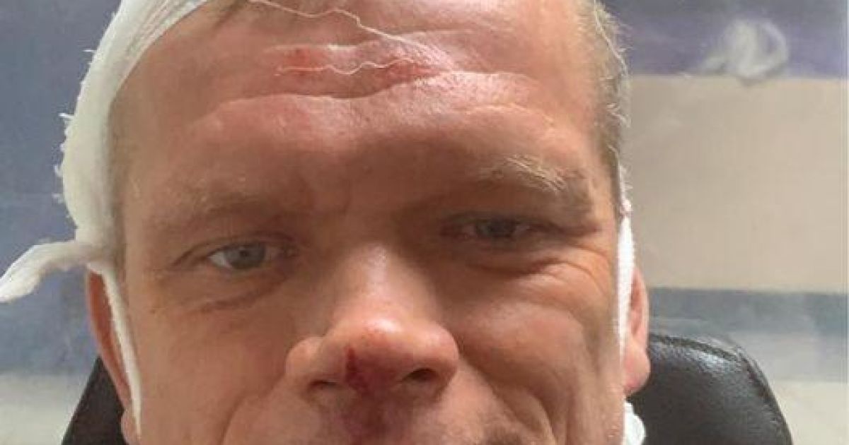 "Гарний початок робочого тижня": у Харківській області розшукують зловмисників, які побили ексміністра