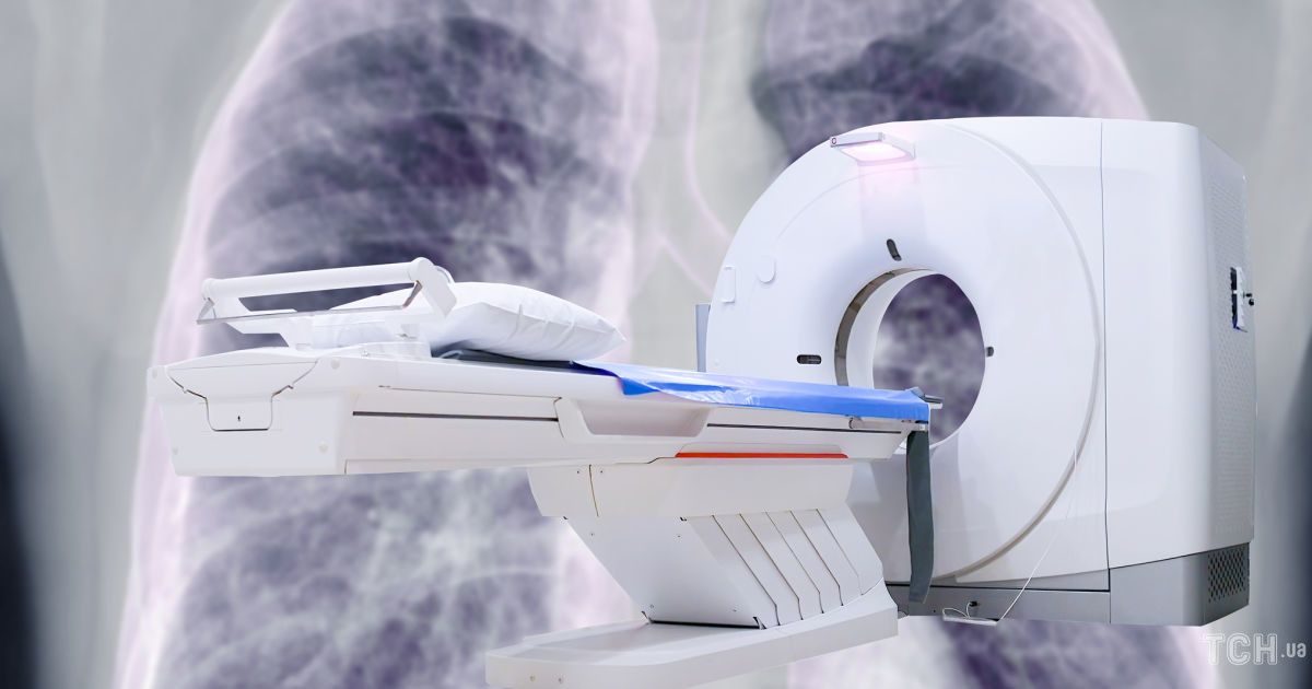 Комп'ютерна томографія (КТ) грудної клітки: показання та переваги