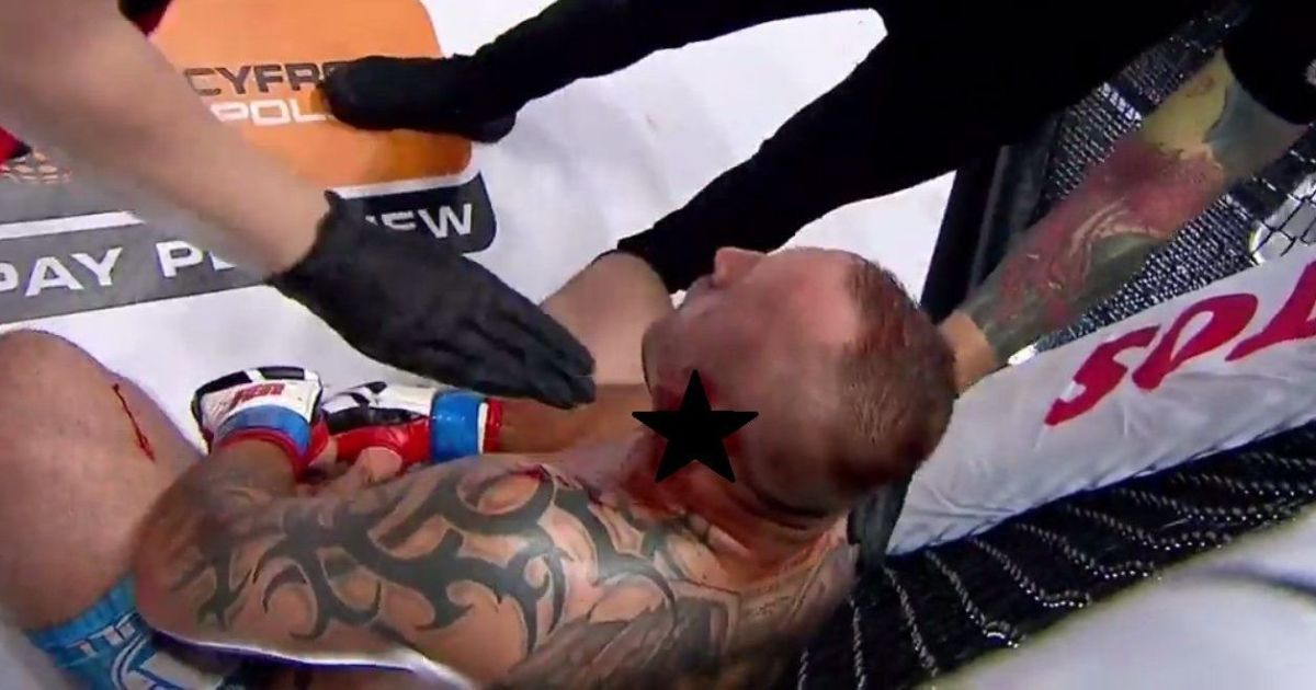 Польському бійцю MMA наполовину відірвали вухо під час бою (відео)