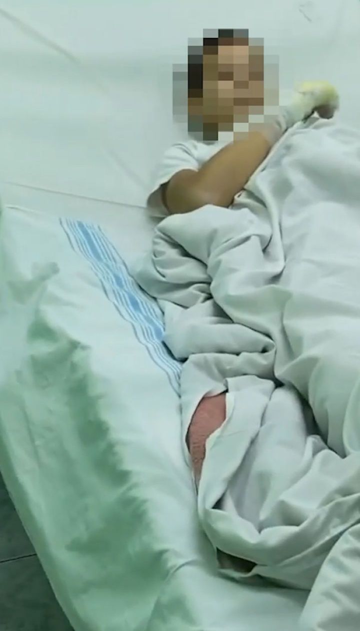 У Бердянську троє підлітків підпалили друга заради відео в Instagram - "Секретні матеріали"
