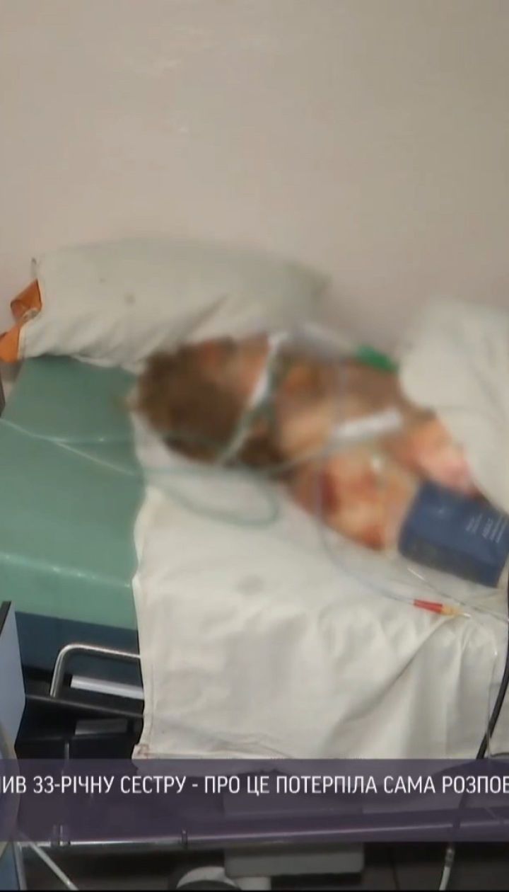 Новорічна сімейна драма: у Хмельницькому намагаються врятувати жінку, яку підпалив рідний брат