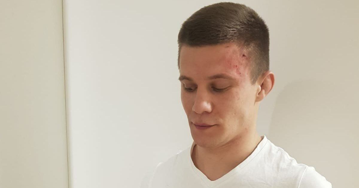 Боєць ММА побив двох дівчат у новорічну ніч та може загриміти до в'язниці: деталі гучного скандалу