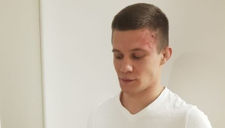 Боєць ММА побив двох дівчат у новорічну ніч та може загриміти до в'язниці: деталі гучного скандалу